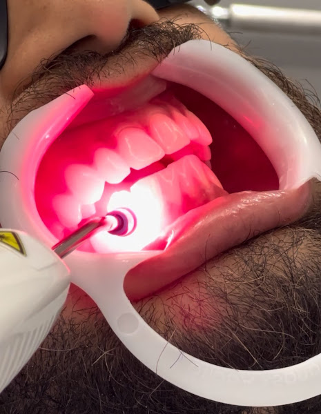 Foto 3 de Dra. Julia Almeida | Periodontia e Reabilitação Oral Estética