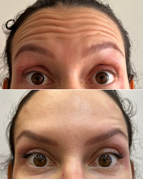 Foto 3 de Dra. Júlia Costa – Harmonização Facial Savassi