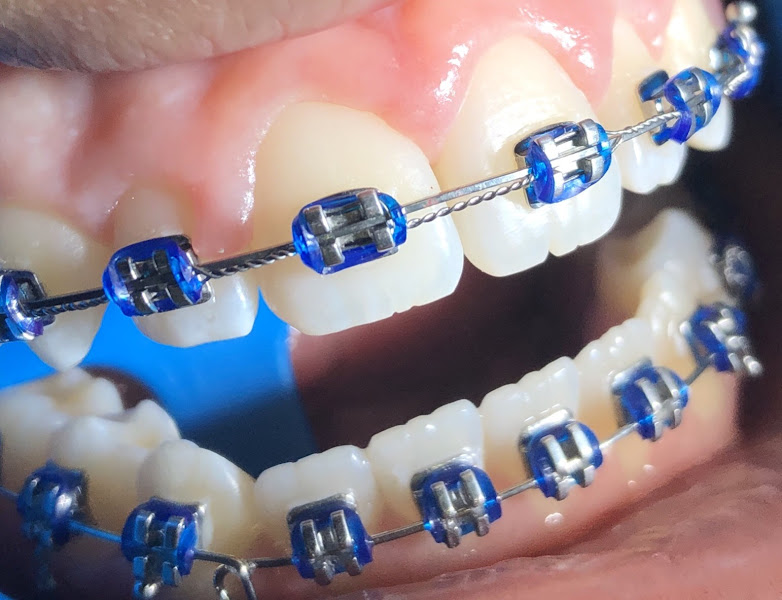 Foto 3 de Dra. Julia Garcia Costa - Ortodontista