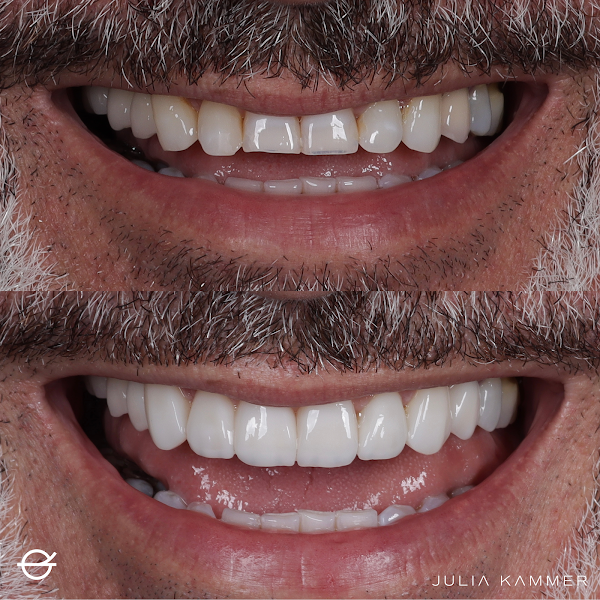 Foto 2 de Dra. Julia Kammer l Odontologia Digital | Implantes Dentários | Facetas