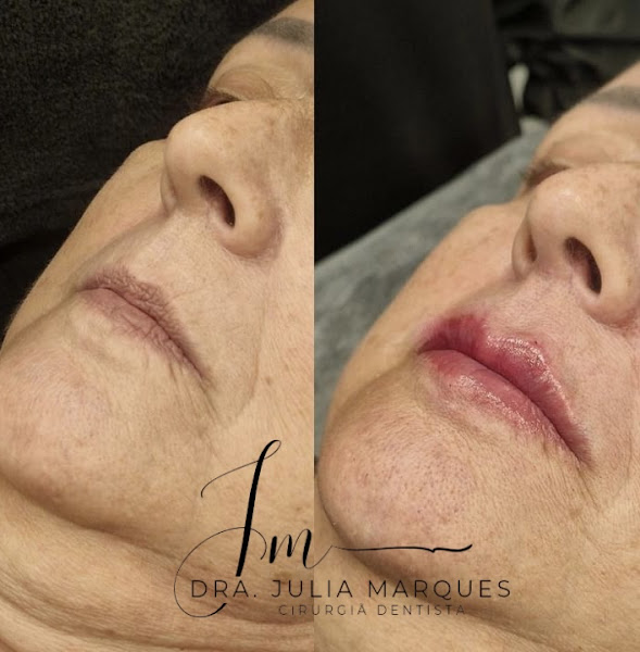 Foto de Dra. Julia Marques- Cirurgiã- Dentista | Estomatologista | Harmonização Orofacial l Clínico Geral