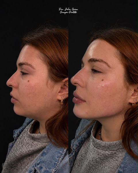 Foto de Dra. Júlia Quina | Harmonização Orofacial