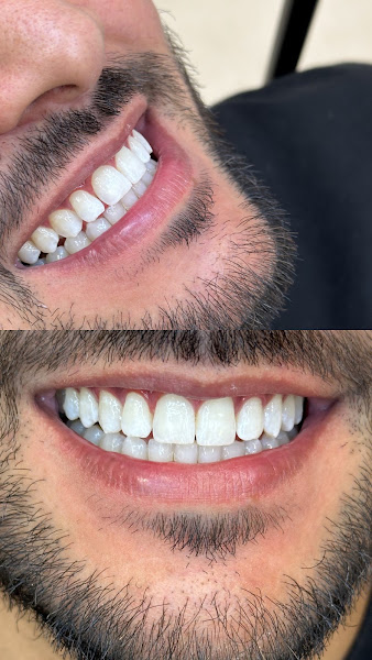 Foto 3 de Dra. Julia Scalzer | Cirurgiã-dentista