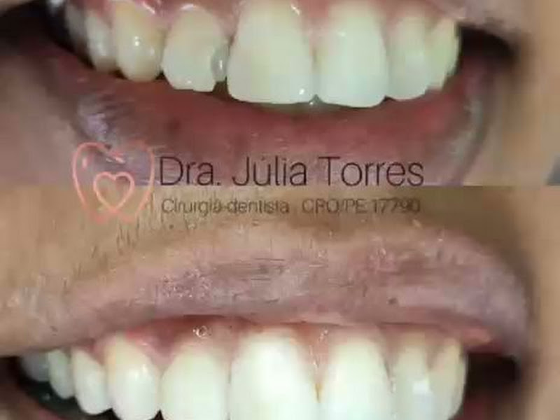 Foto 4 de Dra Júlia Torres - Dentista, Olinda-PE