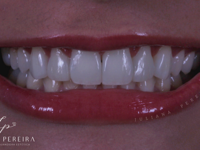 Foto 8 de Dra Júlia Travassos Odontologia em Niterói