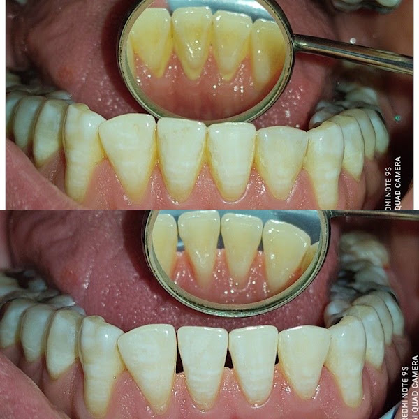 Foto 3 de Dra. Júlia Valentina | Cirurgiã Dentista