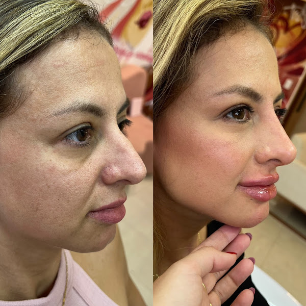 Foto de Dra Julia Vianna - Harmonização Facial