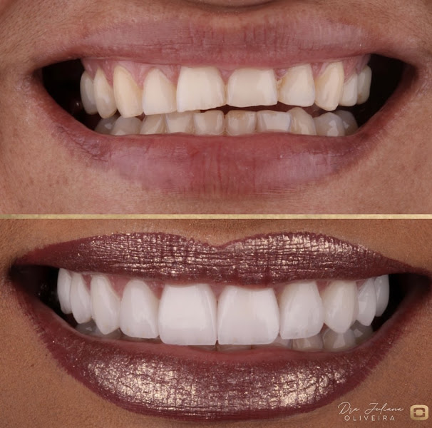 Foto 2 de Dra. Juliana Cardoso - Arte e ciência em Estética Dental