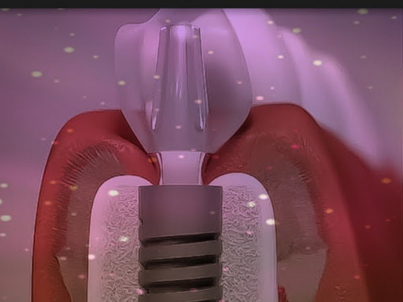 Foto 2 de Dra. Juliana Freitas - Periodontia e Implantodontia