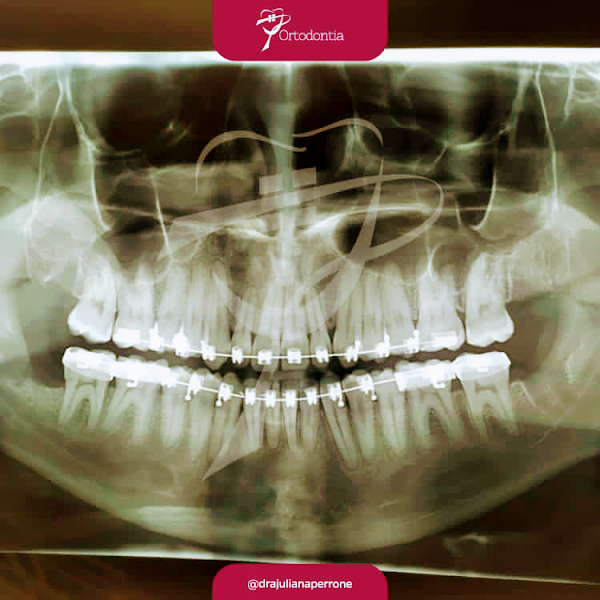 Foto 3 de Dra. Juliana Perrone, Dentista