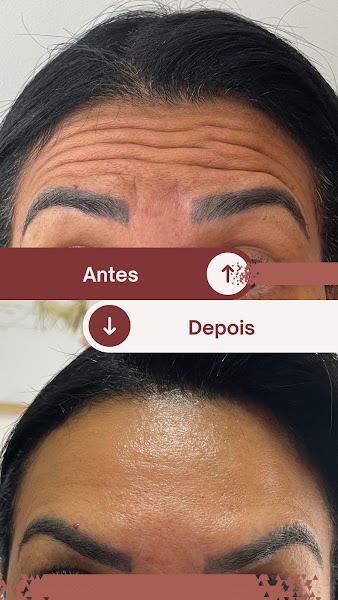 Foto 3 de Dra. Juliana Pinheiro / Harmonização Facial / Centro de São Bernardo do Campo