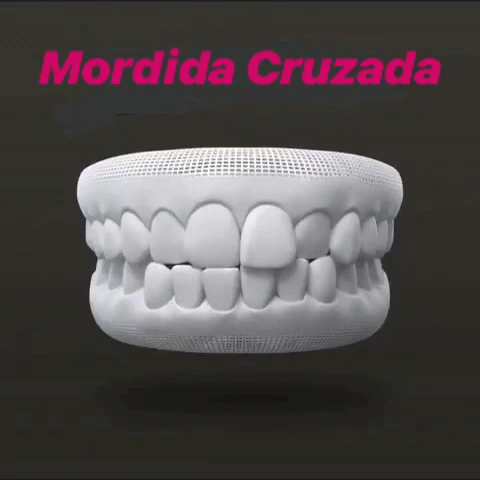 Foto 3 de Dra. Juliana Salazar Odontologia Especializada Ortodontia Invisalign