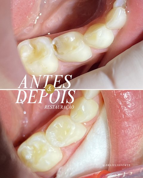 Foto 3 de Dra. Juliane Matheus - Odontologia