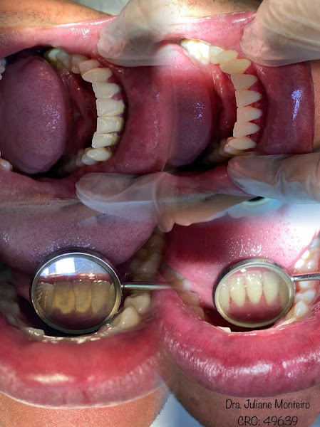 Foto 3 de Dra Juliane Monteiro Ortodontia estética