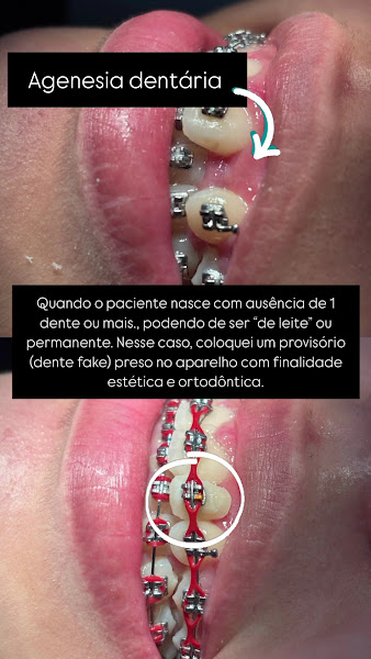 Foto 2 de Dra Julianna Teles - Cirurgiã Dentista | Ortodontia | Roraima