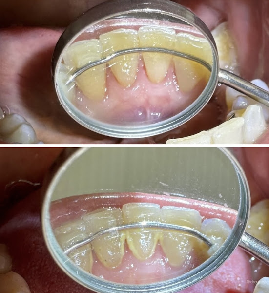 Foto 3 de Dra. Juliê Capucho Odontologia Especializada