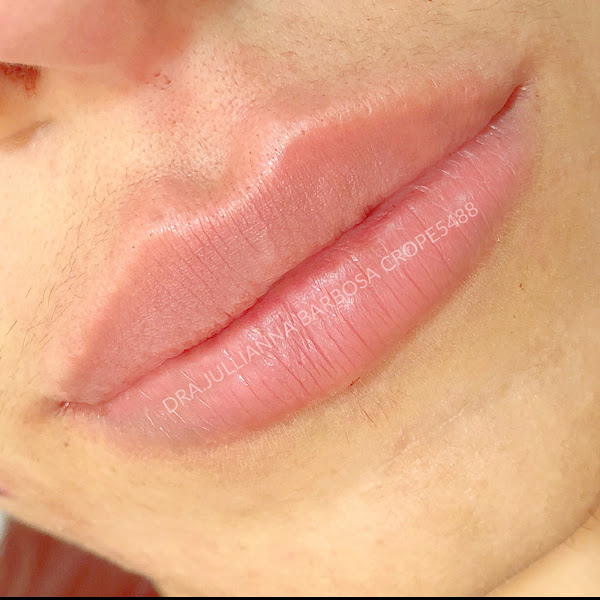 Foto 2 de Dra.Jullianna Barbosa HARMONIZE