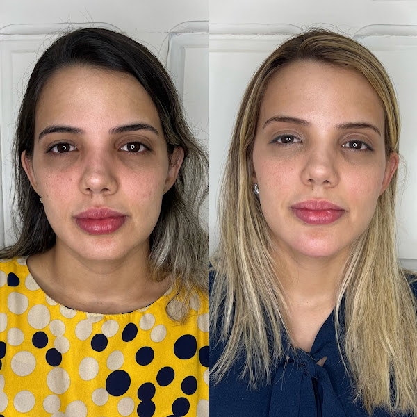 Foto 3 de Dra Kaline Cavalcante