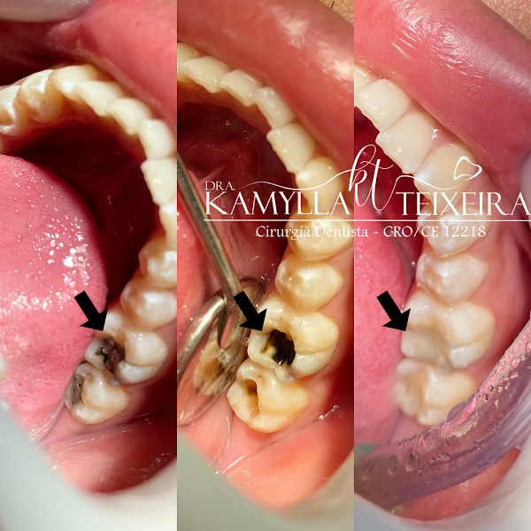 Foto de Dra. Kamylla Teixeira - Odontologia Especializada