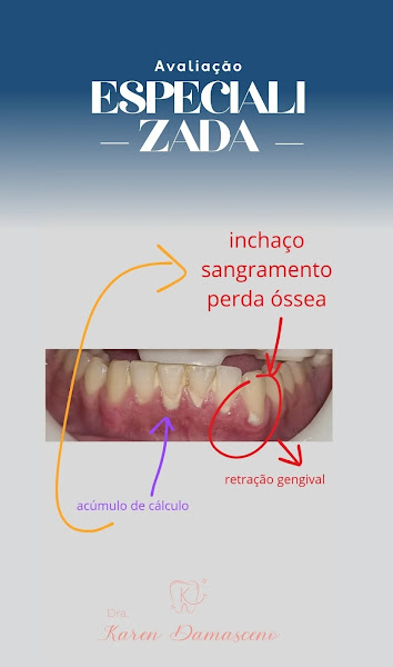 Foto 3 de Dra Karen Damasceno | PERIODONTISTA NITERÓI