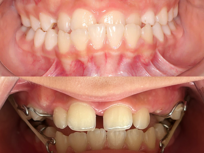 Foto 3 de Dra. Karen Peixoto - Ortodontia, DTM & Bruxismo | Dentista em Natal