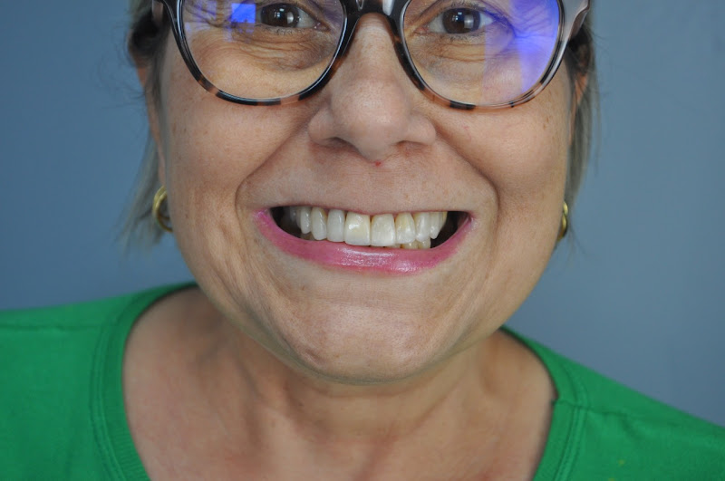 Foto 2 de Dra Kárin Borges | Facetas em Resende