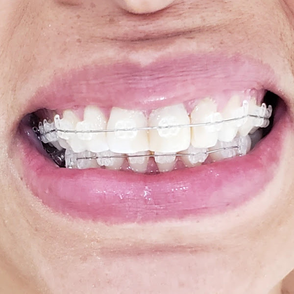 Foto 3 de Dra. Karina Santos Oliveira - Periodontista e Ortodontista