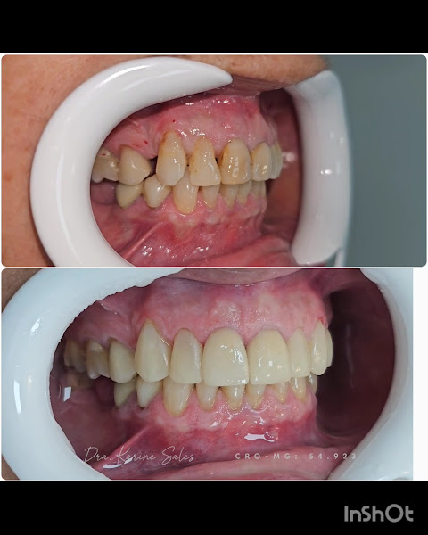Foto 3 de Dra. Karine Sales- ODONTOLOGIA