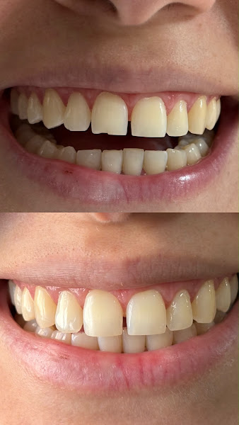 Foto 2 de Dra. Karolina Azevedo | Odontologia