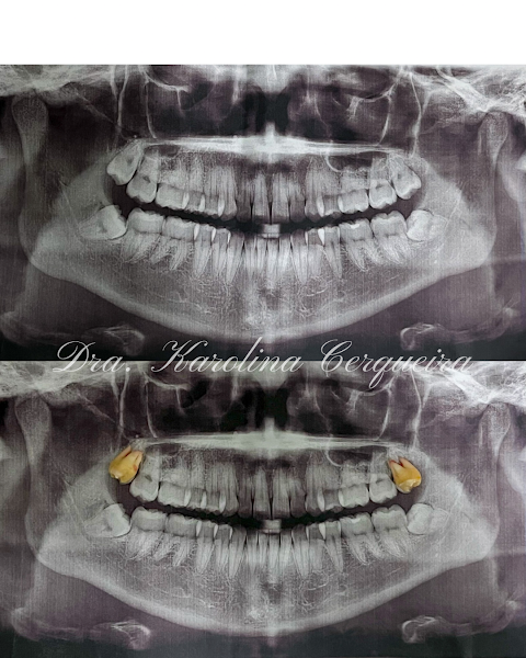 Foto 3 de Dra. Karolina Cerqueira | Dentista em Salvador