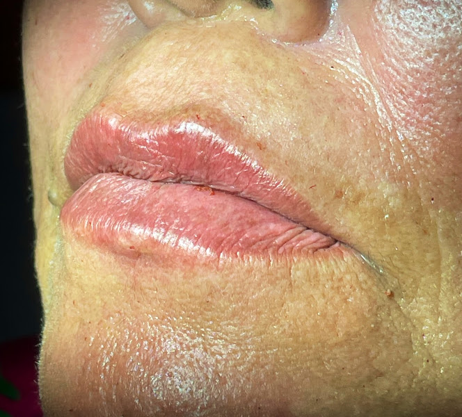 Foto 3 de Dra. Karoline Santos - Harmonização Facial | Botox | Preenchimento | Fios de PDO