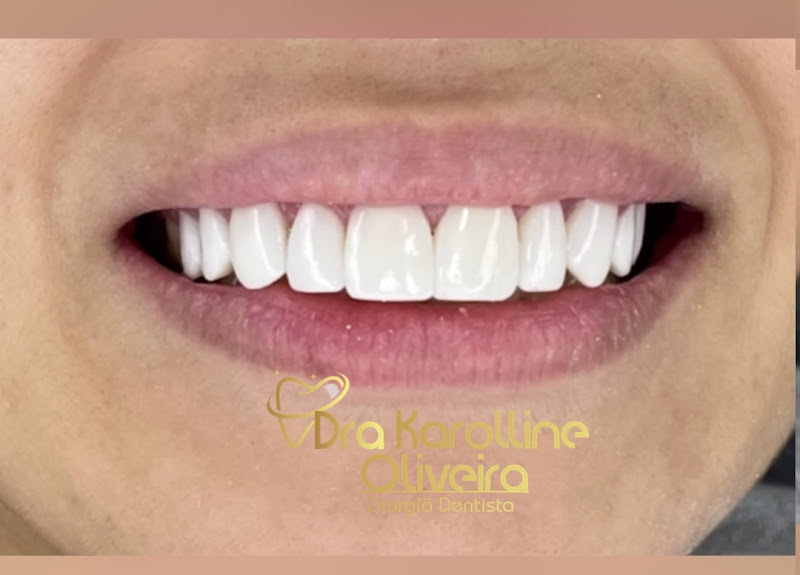 Foto 4 de Dra. Karolline Oliveira – Dentista em Guarulhos | Especialista em Facetas 3D, Implantes e Sedação Consciente