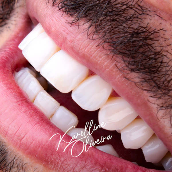 Foto 5 de Dra. Karolline Oliveira – Dentista em Guarulhos | Especialista em Facetas 3D, Implantes e Sedação Consciente