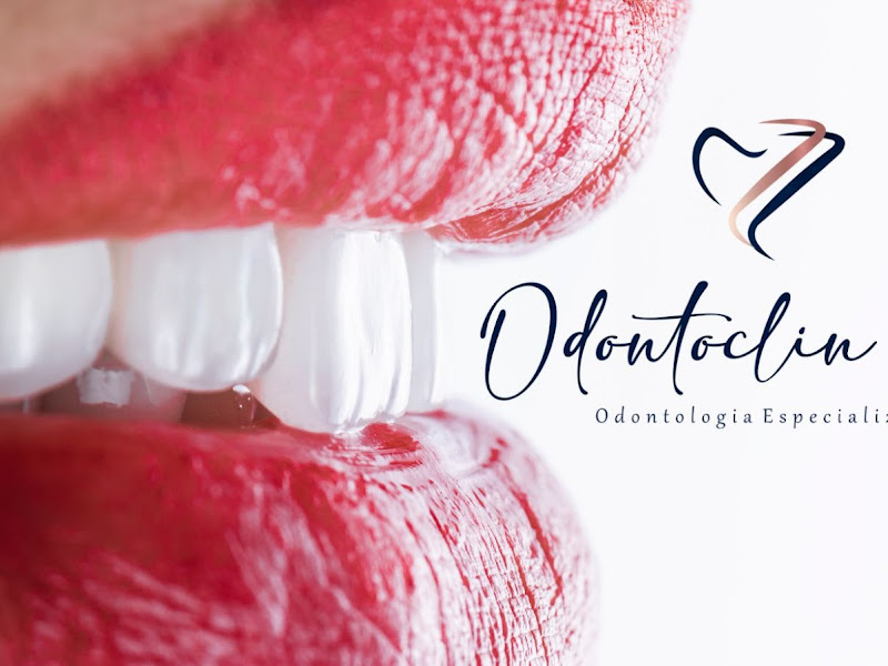 Foto 11 de Dra. Karolline Oliveira – Dentista em Guarulhos | Especialista em Facetas 3D, Implantes e Sedação Consciente