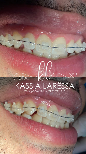 Foto 3 de Dra Kassia Larêssa | Dentista Fortaleza
