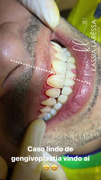 Foto 4 de Dra Kassia Larêssa | Dentista Fortaleza