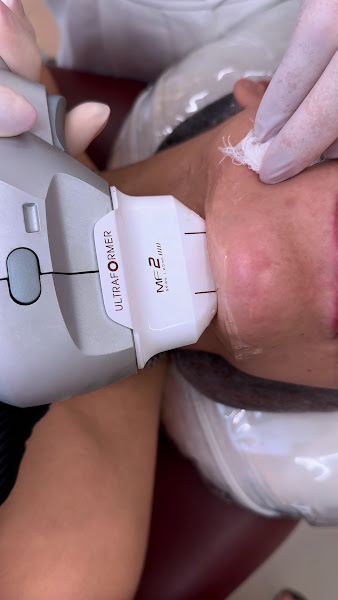 Foto 3 de DRA KATARINA BESSA - HARMONIZAÇÃO FACIAL EM NATAL