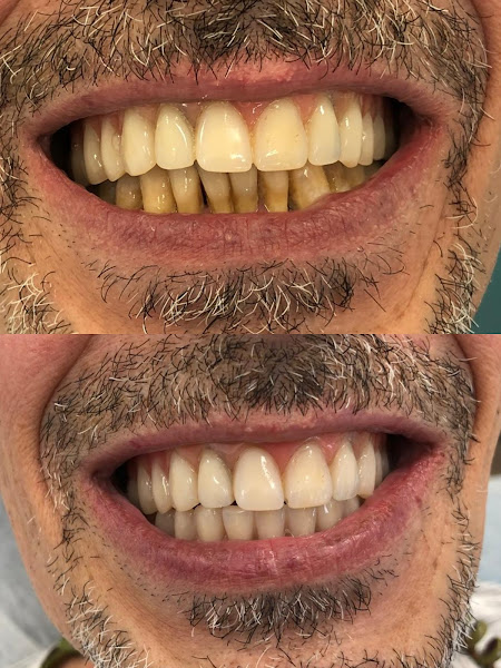 Foto 3 de Dra Katia Albuquerque - Dentista