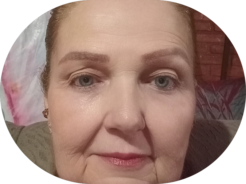 Foto 5 de Dra. Katia Boaventura Dentista em Cuiabá | Facetas em resina | Reabilitação Oral | Estética Dental | Implantes