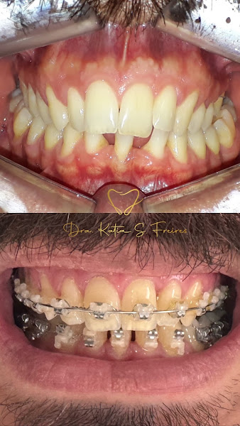 Foto 3 de Dra. Katia S. Freires - Cirurgiã-Dentista