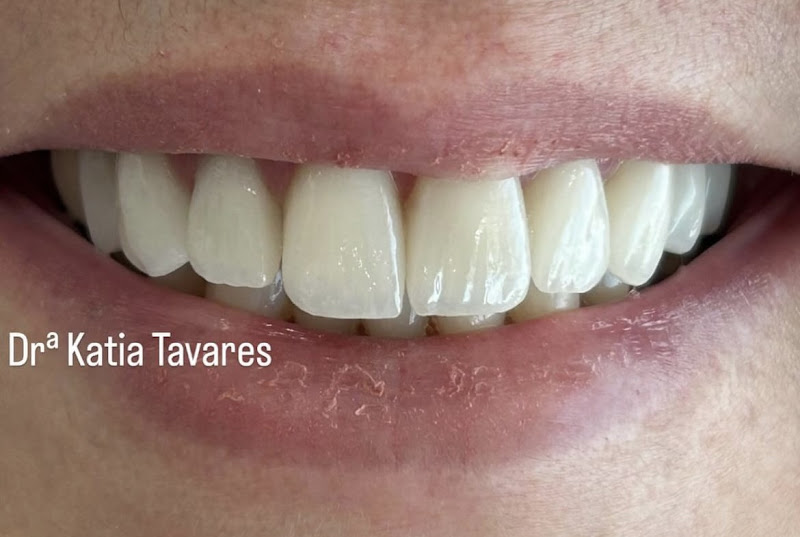 Foto 2 de Dra Katia Tavares /Implantodontista