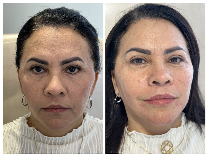 Foto 3 de Dra Kelly de Paula - Harmonização Facial RJ