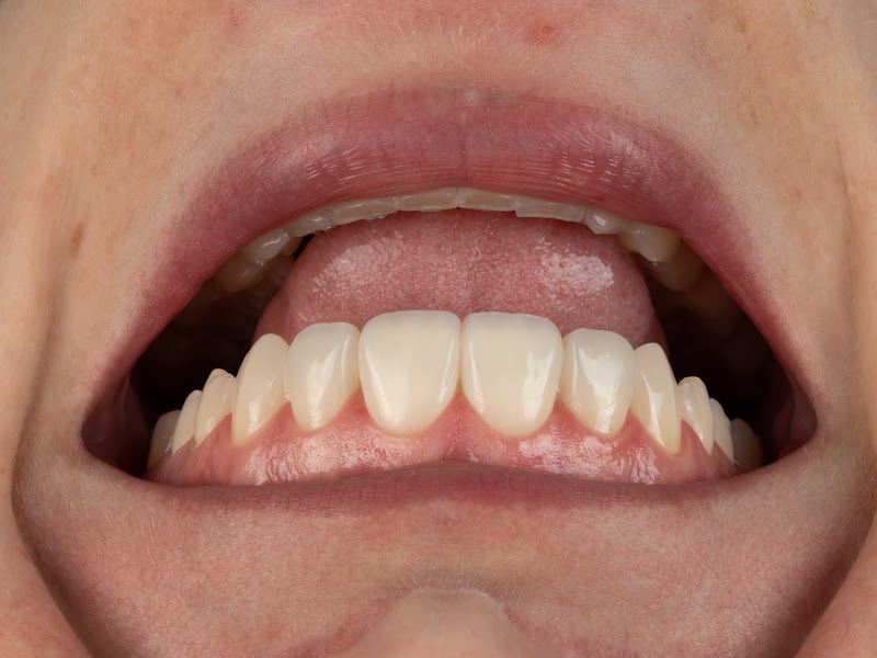 Foto 3 de Dra Kenisa Enderle - Odontologia estética, reabilitadora e preventiva.