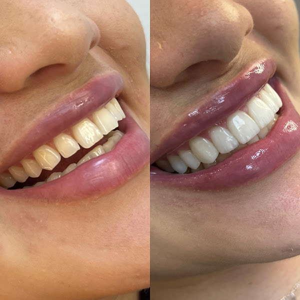 Foto 2 de Dra. Keslen Geffer - Odontologia