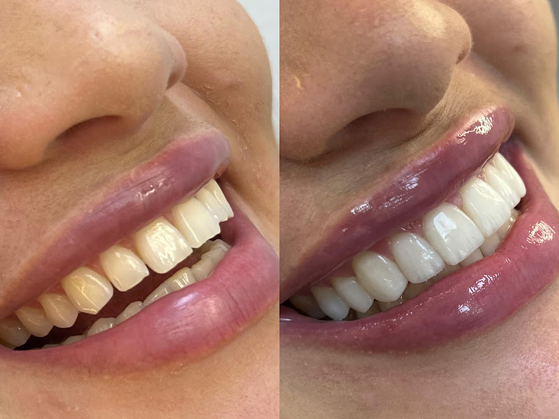 Dra. Keslen Geffer - Odontologia