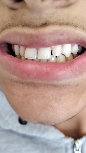 Foto 3 de Dra Ketiney Jamile | Dentista em Atibaia