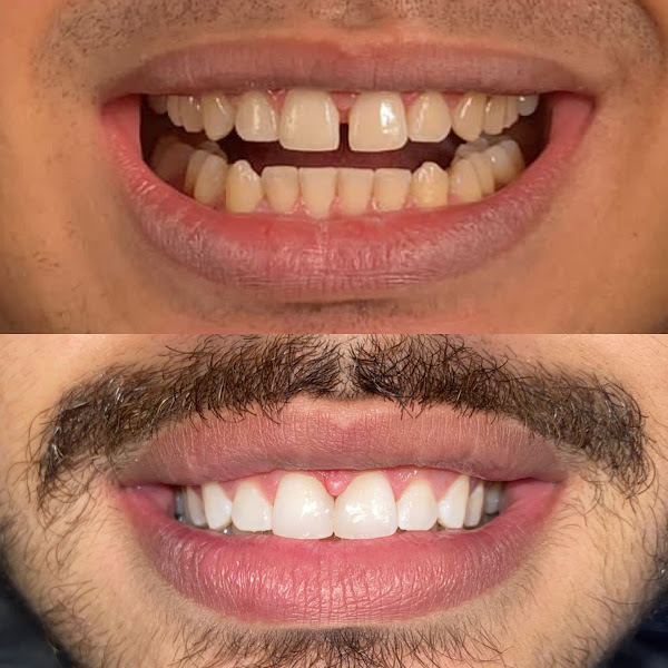 Foto 2 de Dra Kilvia Lima, Dentista