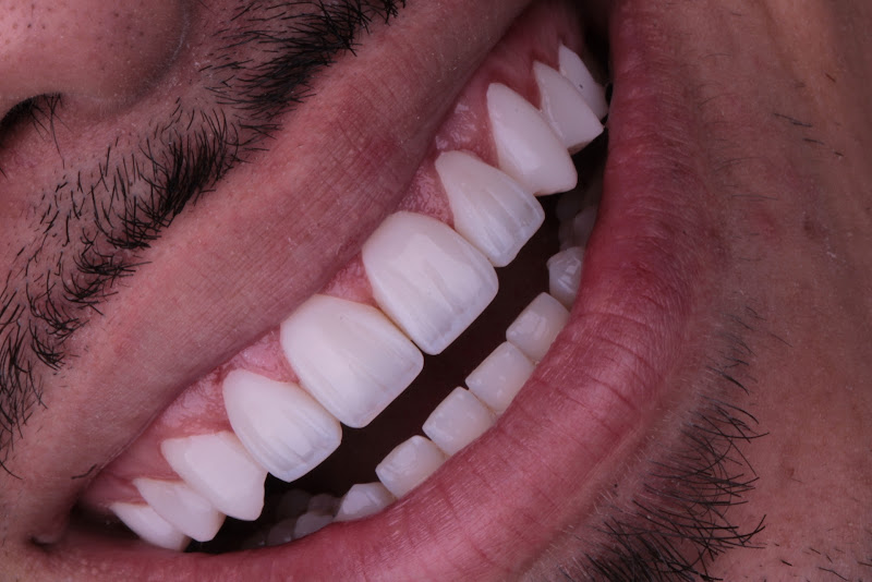 Foto 2 de Dra Laira Rabito-Cirurgia Dentista