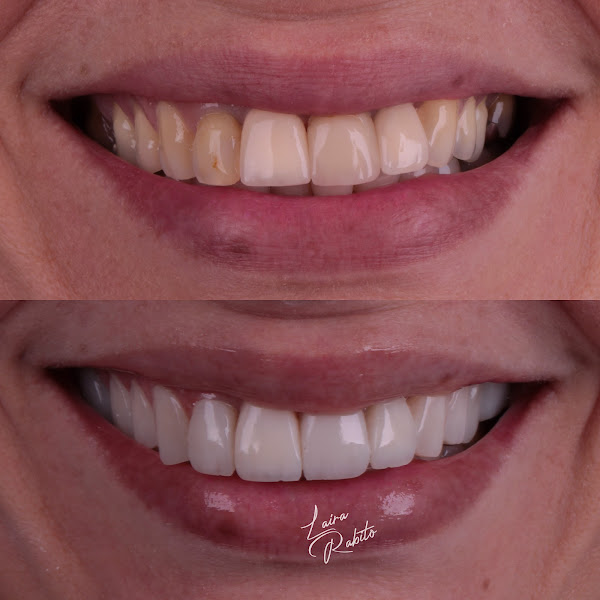 Foto 3 de Dra Laira Rabito-Cirurgia Dentista