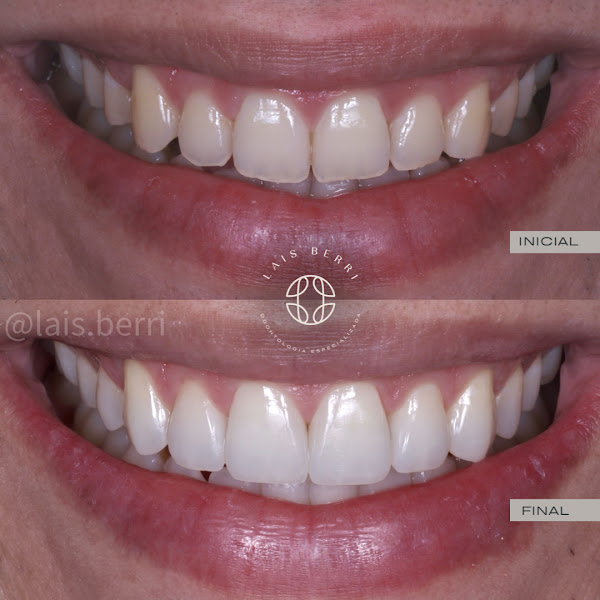 Foto 2 de Dra. Lais Berri - Odontologia Especializada